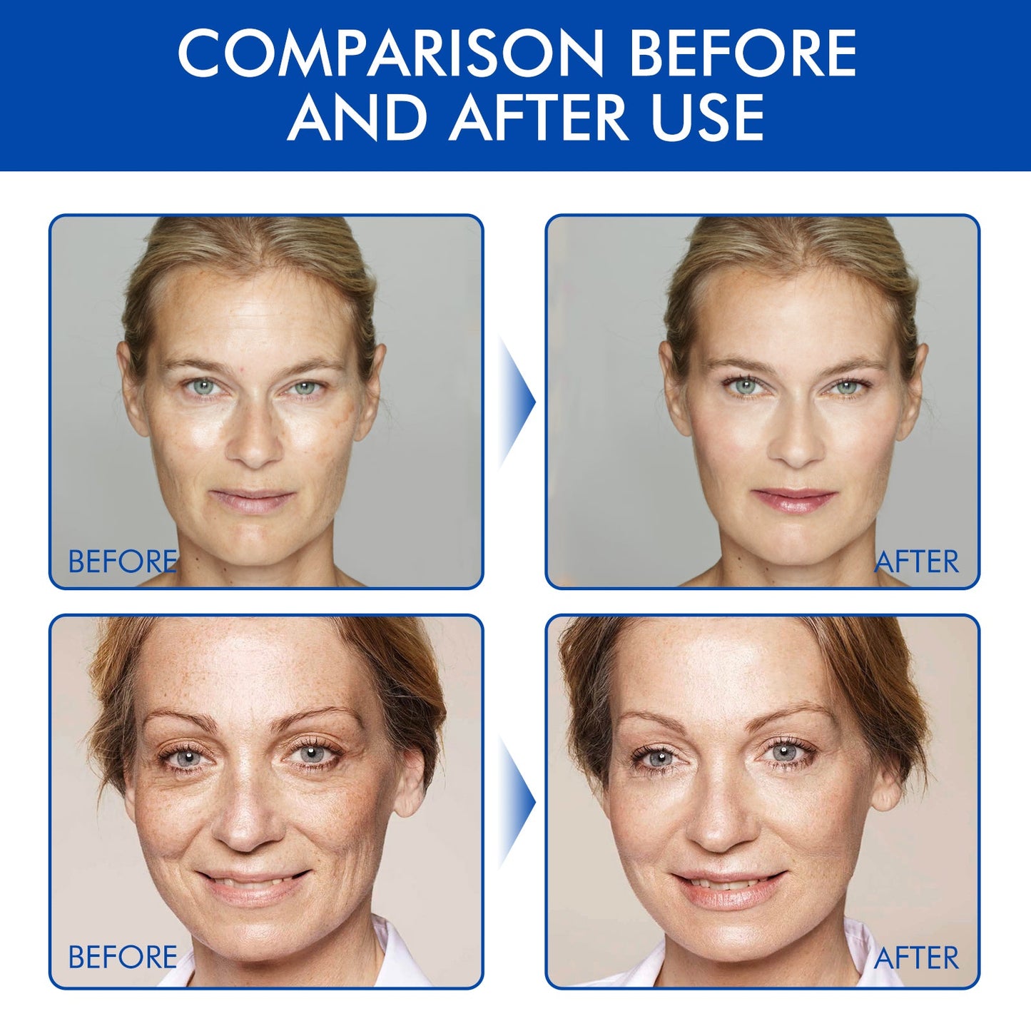 Firming Facial Botox Serum | Fight Aging! 💉✨