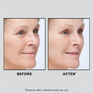 Today 49% OFF🎁Temporary Face Tightener