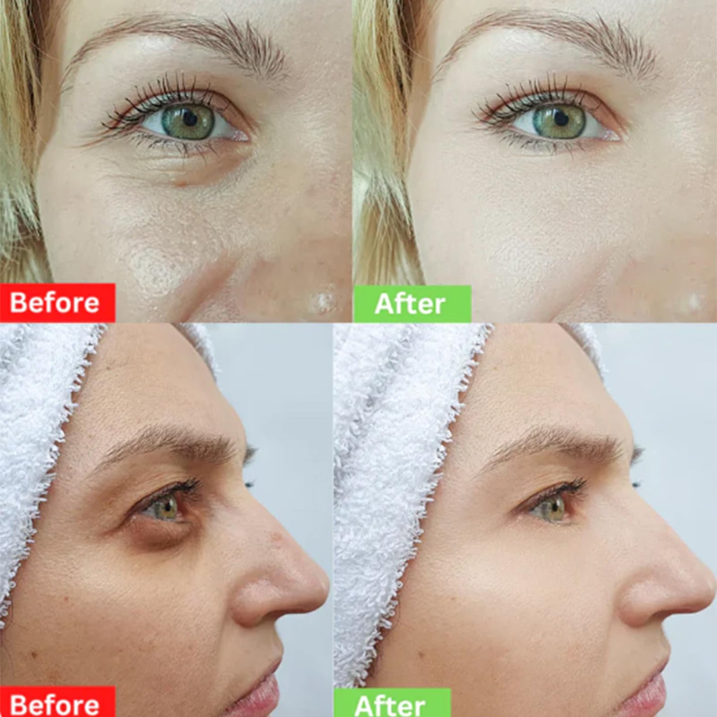 Today 49% OFF🎁Temporary Face Tightener